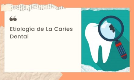 Etiología de La Caries dental