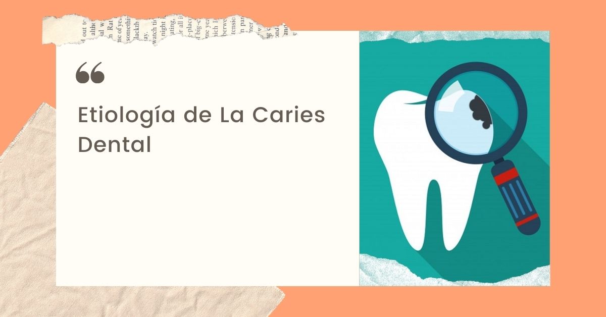 Etiología de La Caries dental